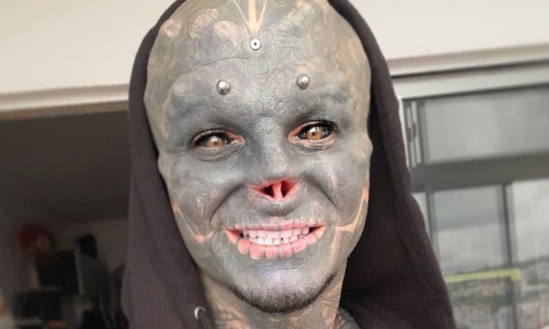 Apres-son-nez-le-Black-Alien-francais-se-fait-enlever-la-levre