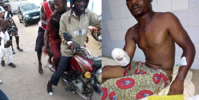 Benin-Crise-post-electorale-les-clarifications-de-lhomme-au-bras-ampute-par-le-gaz-lacrymogene