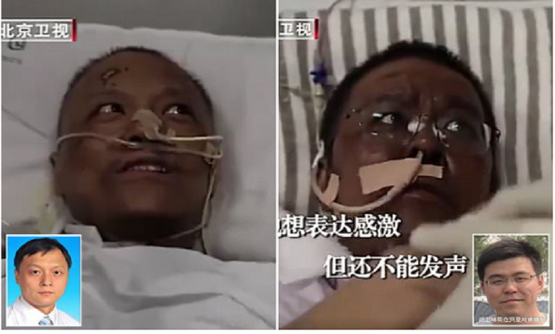 COVID-19-des-medecins-chinois-contamines-se-retrouvent-avec-une-peau-sombre