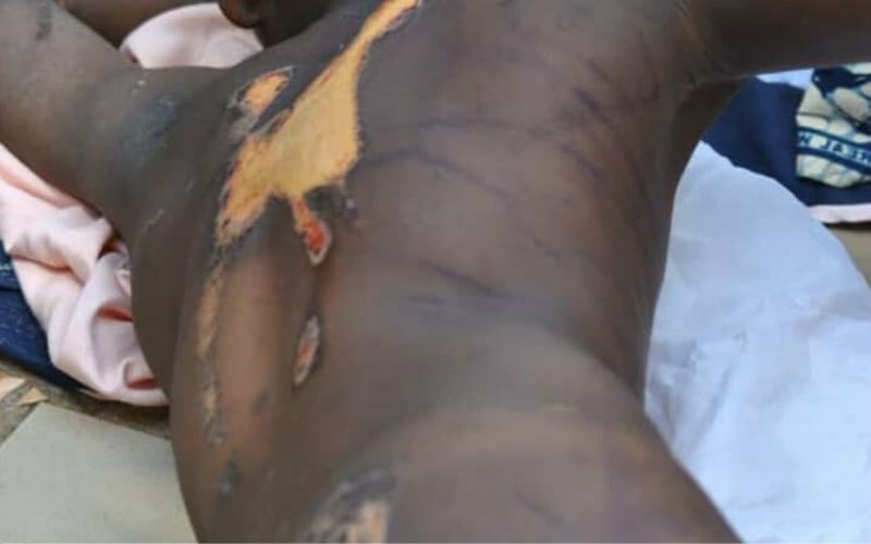 Elle-perce-la-tete-de-sa-domestique-avec-des-clous-et-brule-son-corps-avec-du-fer-a-repasser-photos