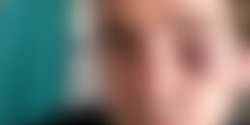 France-Il-ouvre-sa-porte-et-recoit-des-coups-de-couteau-et-de-batte-de-baseball