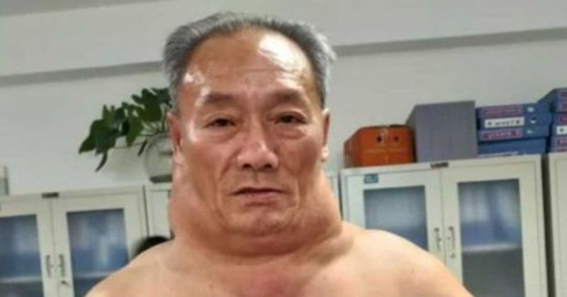 Il-boit-un-litre-dalcool-par-jour-depuis-ses-13-ans-et-contracte-une-maladie-rare