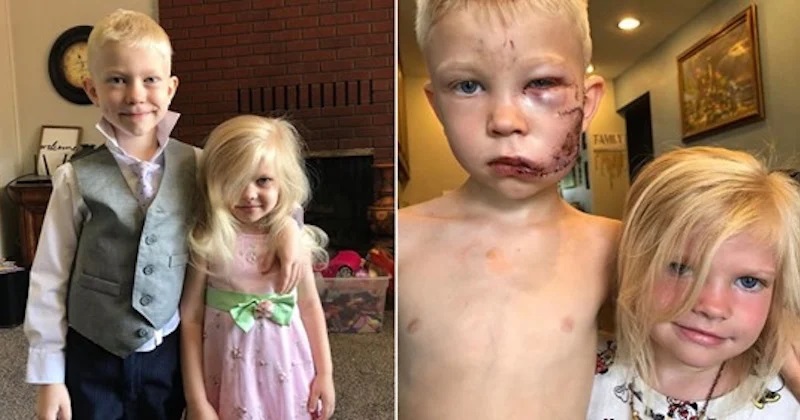 Il-sauve-sa-soeur-de-lattaque-dun-chien-et-recoit-le-soutien-des-Avengers