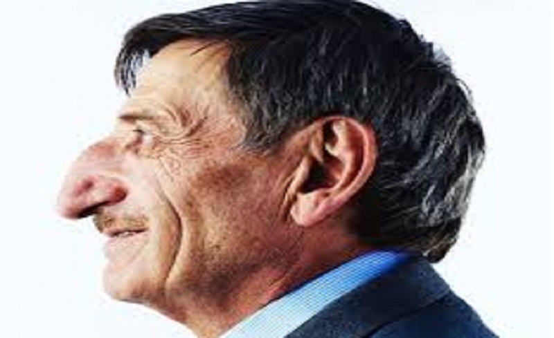 Le-nez-de-cet-homme-mesure-88-cm