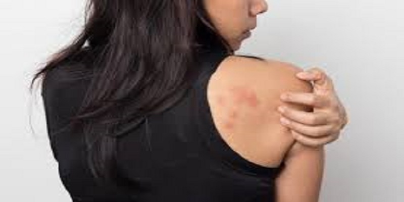 Les-dermatologues-mettent-en-garde-contre-deventuels-symptomes-cutanes-du-coronavirus