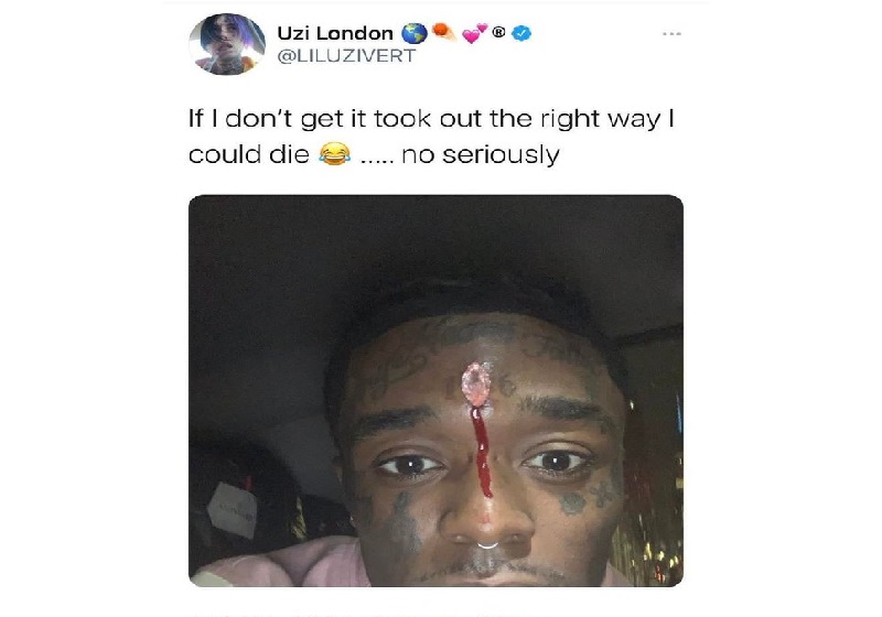 Lil-Uzi-Vert-sur-son-diamant-au-front-Je-pourrais-mourir-si-je-ne-le-retire-pas