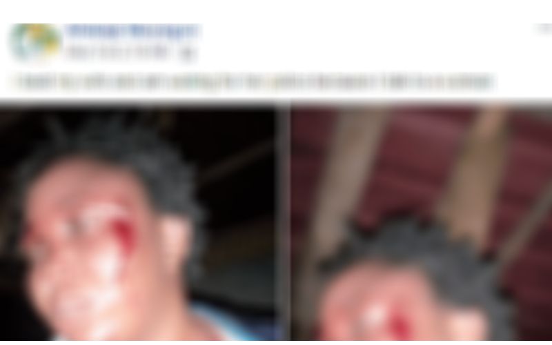 Nigeria-Un-homme-bat-sa-femme-et-publie-les-photos-sur-Facebook