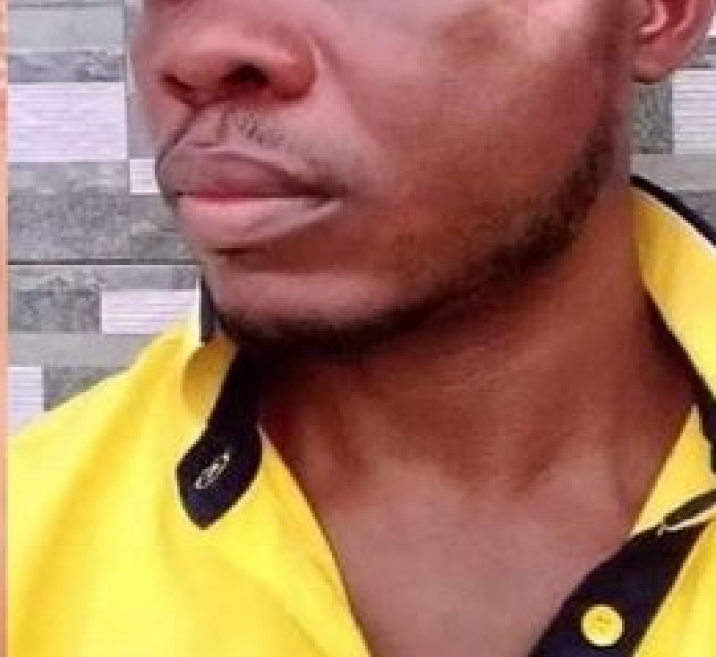 Nigeria-un-homme-vomit-la-balle-logee-dans-sa-tete-des-mois-apres