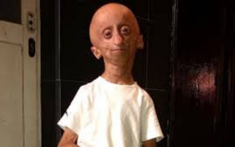 Rania-la-star-des-reseaux-sociaux-atteinte-de-progeria-est-morte