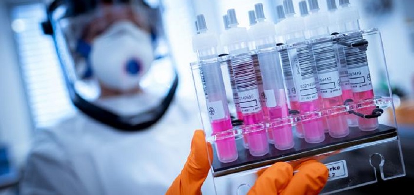 Togo-le-test-de-depistage-du-coronavirus-sera-desormais-payant