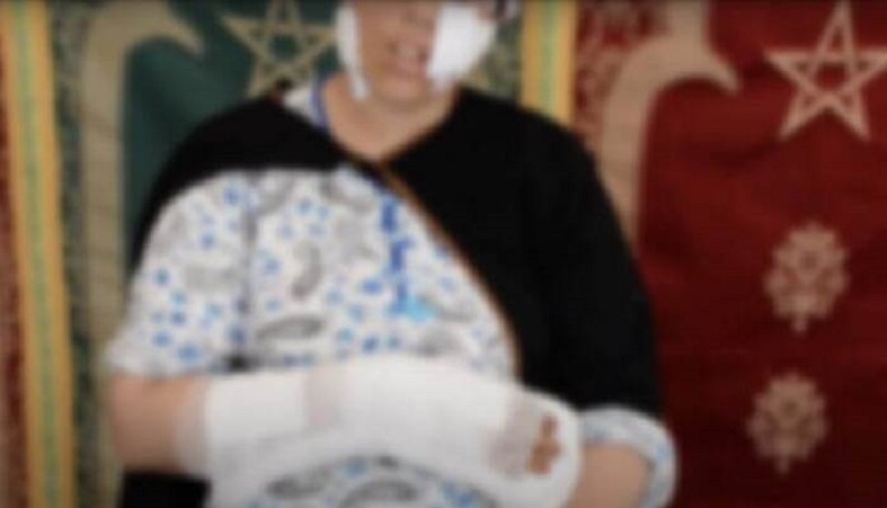 Une-Marocaine-defiguree-par-son-mari-avec-une-machette-pour-une-question-de-jalousie-video