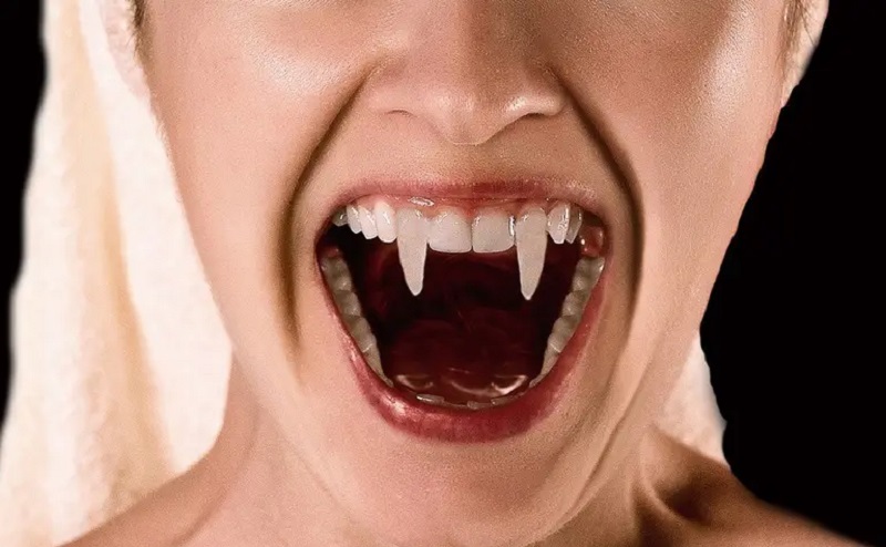 Une-femme-se-retrouve-aux-urgences-a-cause-de-ses-dents-de-vampire