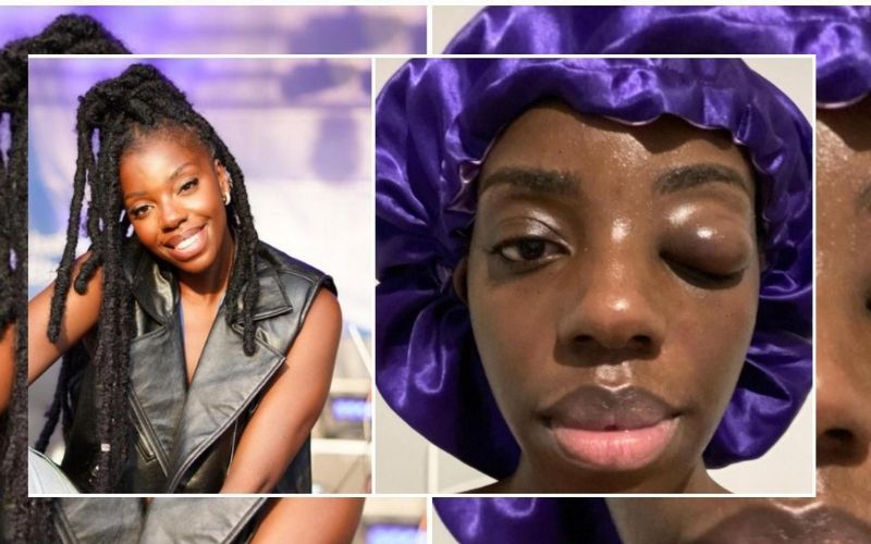 Jeny Bosenge les images de la danseuse et influenceuse frappée par son ex-mari enflamment la toile