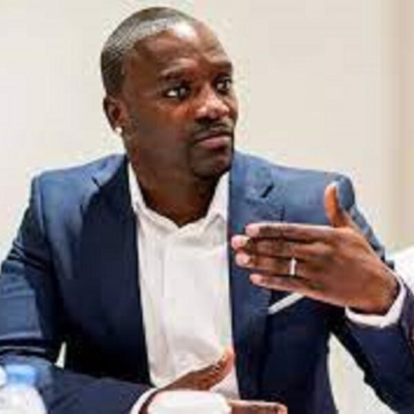 Akon : cette folle somme dépensée par le chanteur pour une greffe de cheveux