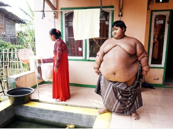 Le garçon le plus gros du monde subit une transformation incroyable après avoir perdu du poids (photo)