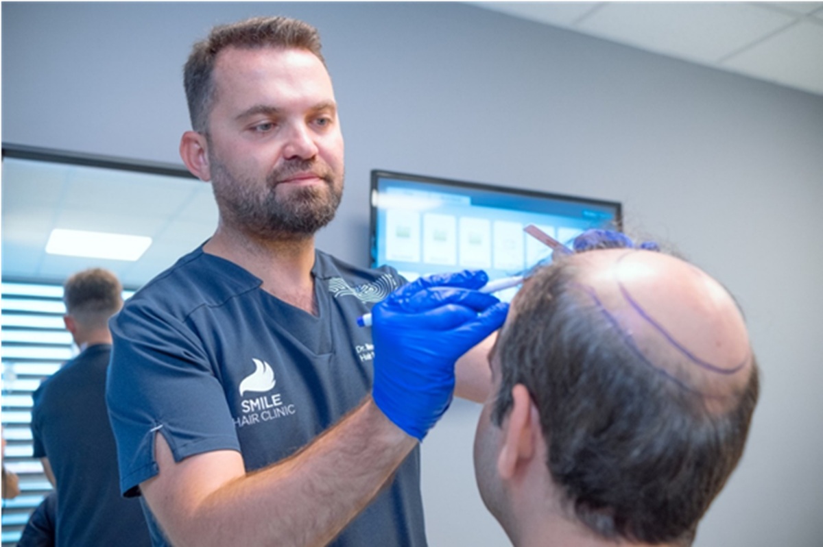 Greffe de Cheveux Turquie-A-L’excellence médicale avec Smile Hair Clinic à Istanbul